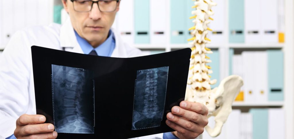 Spinal Cord Injury Doctor