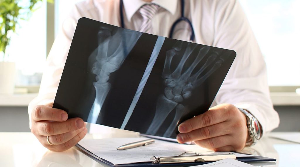Bakersfield Personal Injury Medical Evidence