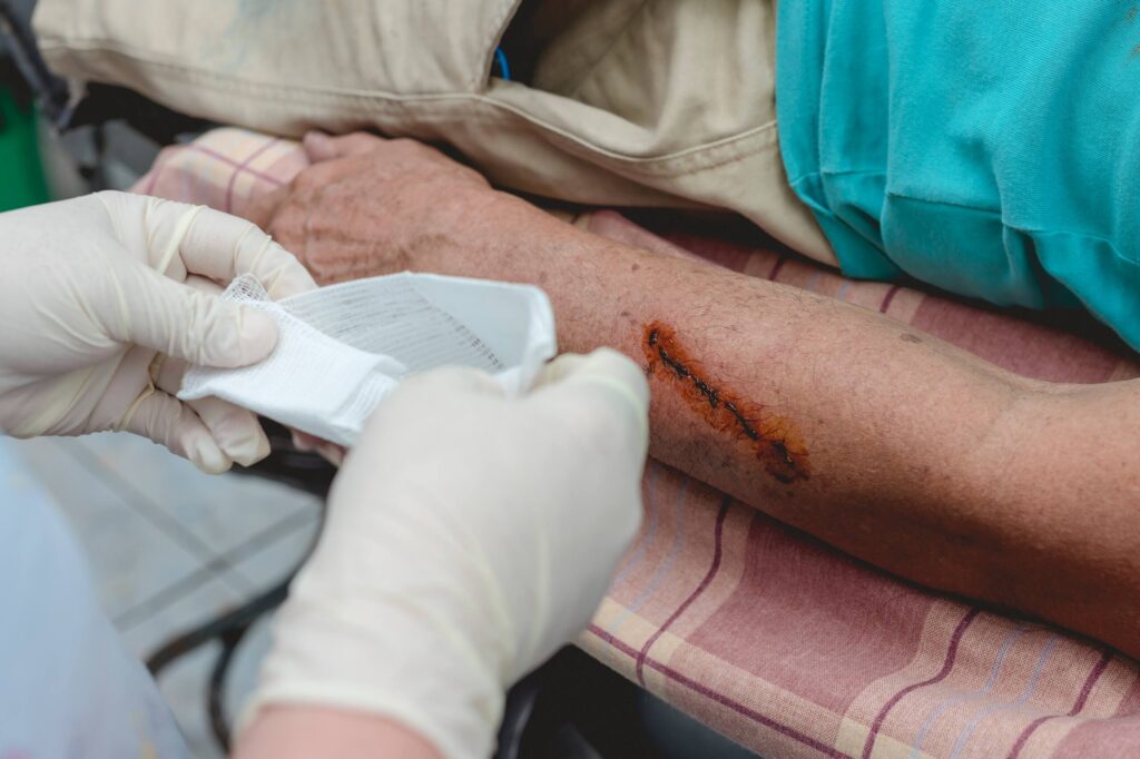 A medical professional applying gauze to a arm laceration helps determine is your Bakersfield dog bite infected.