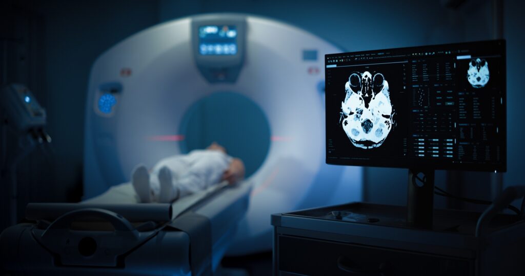 Advanced brain imaging used to assess traumatic brain injury recovery for patients in Bakersfield