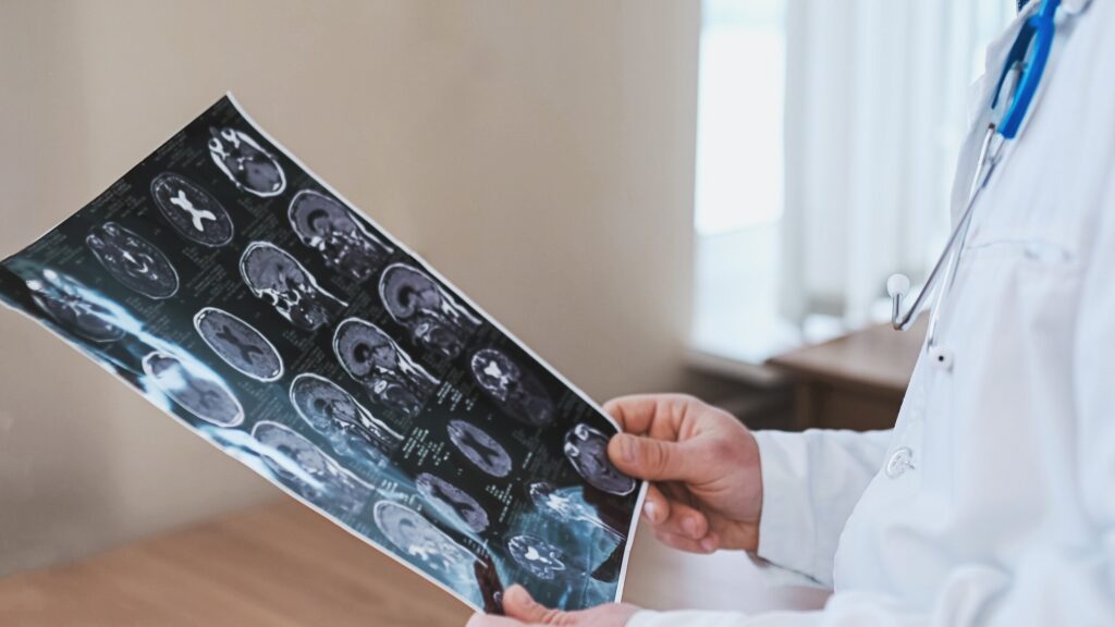 A doctor in a lab coat examining a brain MRI scan.